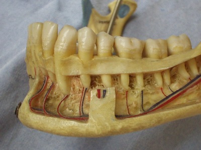 fasci-vascolonervosi-mandibola.JPG